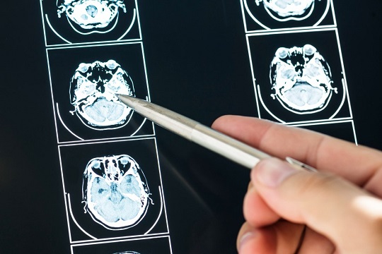 mri